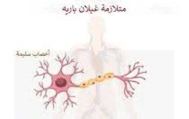 متلازمة غيلان باريه… المرض النادر اللي ممكن يقلب حياتك في أيام