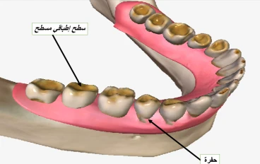تآكل الأسنان: أسبابه، أعراضه، وطرق الوقاية