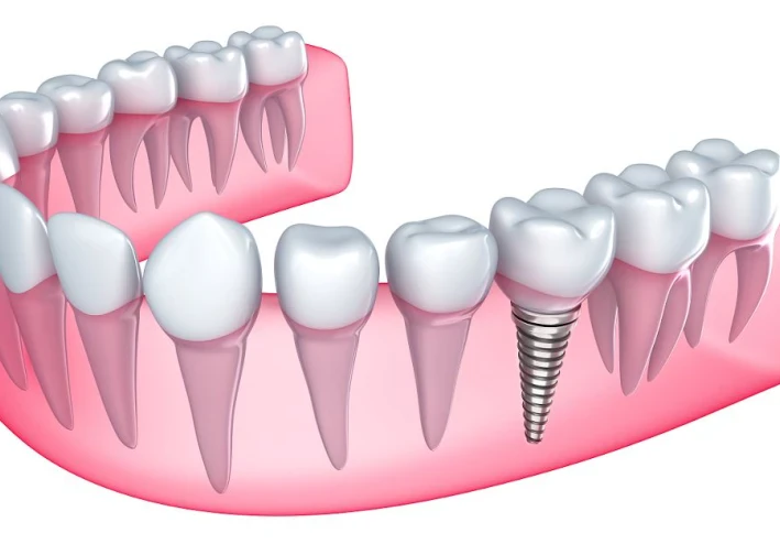 8 حقائق مذهلة عن طب الأسنان تحتاج إلى معرفتها