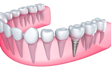 8 حقائق مذهلة عن طب الأسنان تحتاج إلى معرفتها