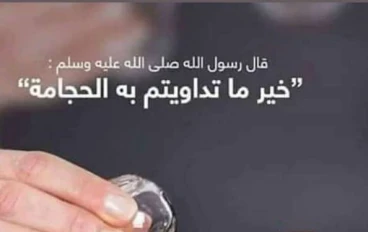 الحجامة.. طب بديل أم علاج طبيعي؟