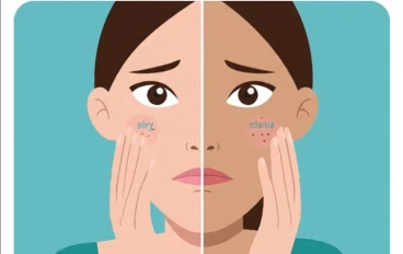 ✨ أهمية تحديد نوع البشرة: سر العناية الصحيحة بجمالك