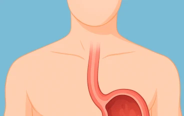 قرحة المعدة وأحدث طرق علاجها