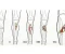 صورة مقال تصنيف جوستيلو (Gustilo Classification)