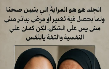 🔥 الصدفية (Psoriasis): مرض جلدي مزمن بيشغل بال ملايين البشر
