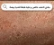 صورة مقال التخلص من جفاف الجلد وقشور الجلد في الصيف