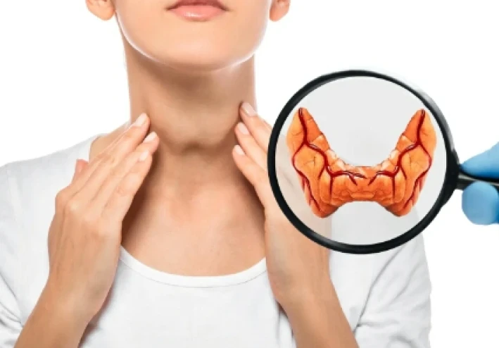 نشاط الغده الدراقيه