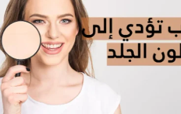 فرط التصبغ واسمرار الجلد