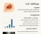 صورة مقال جروح الطلقات النارية (Gun Shot Wounds)