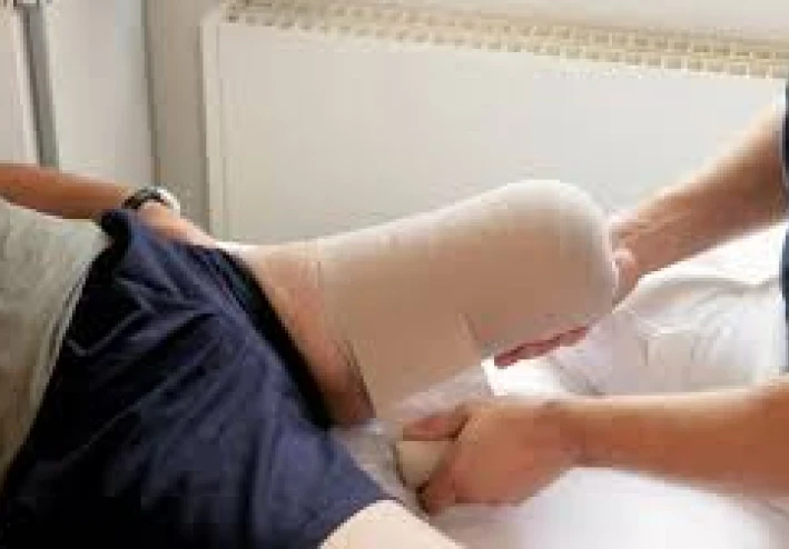 أنواع عمليات البتر (Amputations)