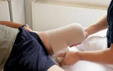 أنواع عمليات البتر (Amputations)