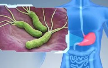 علاج جرثومة المعدة نهائيًا في 14 يومًا فقط