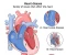 article image for امراض القلب واسبابها