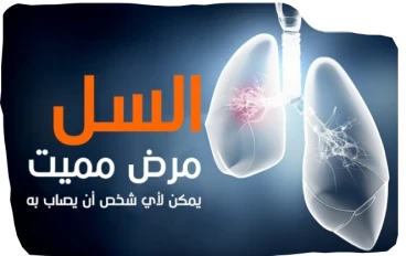 السل: الأعراض التفصيلية، طرق الانتقال، والوقاية والعلاج