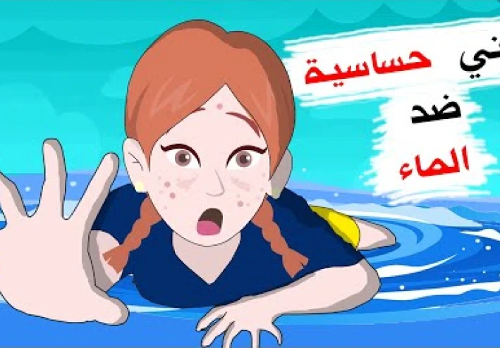 حساسيه الماء ( الشري المائي )