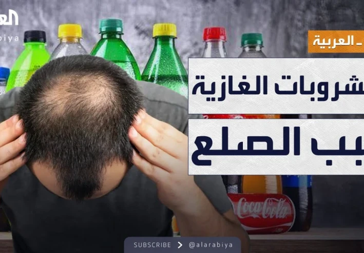 هل المشروبات السكرية تسبب تساقط الشعر؟ دراسة تكشف تأثيرها على شباب اليوم