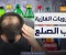 صورة مقال هل المشروبات السكرية تسبب تساقط الشعر؟ دراسة تكشف تأثيرها على شباب اليوم
