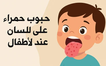 حبوب حمراء على اللسان عند الأطفال: دليل شامل للأسباب وطرق الوقاية والعلاج
