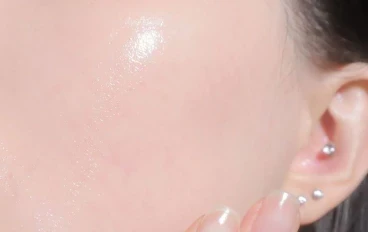 أفضل 7 طرق طبيعية للحصول علي بشرة صافيه 