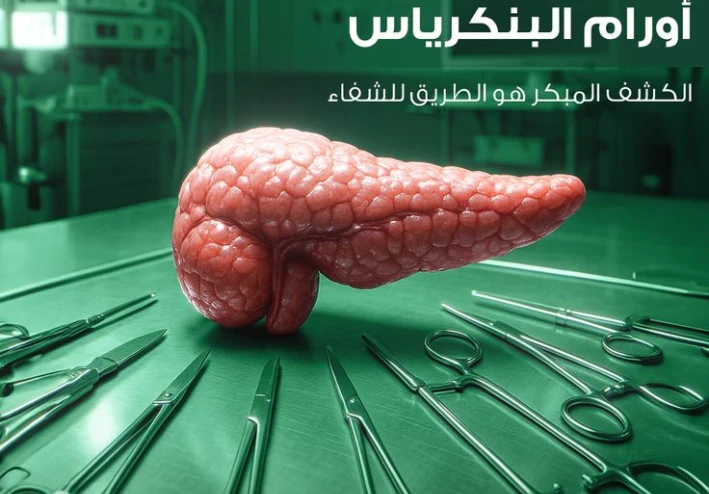 أورام البنكرياس: بين التشخيص والعلاج