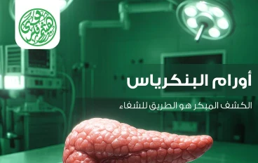أورام البنكرياس: بين التشخيص والعلاج