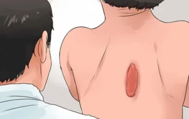 صحه الجلد في مواجهه الضغط
