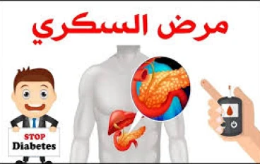 ثورة الذكاء الاصطناعي في مواجهة مرض السكري