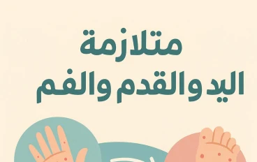 فيروس متلازمة اليد والقدم والفم عند الاطفال