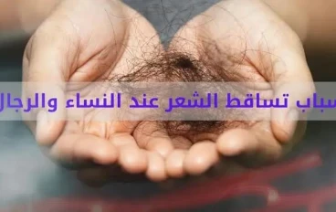 13 سبب لتساقط الشعر