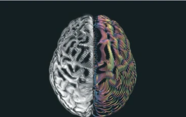 النتائج المفاجئة في الأشخاص الذين لديهم نصف دماغ فقط