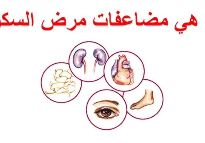كم يجب أن يكون معدل السكر الطبيعي في الدم؟