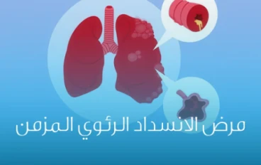 الانسداد الرئوي المزمن
