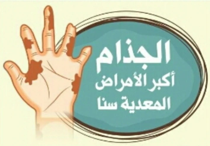 الحقيقه وراء مرض الجذام
