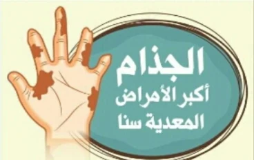الحقيقه وراء مرض الجذام