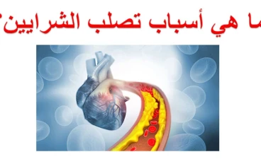 تصلب الشرايين لدى مرضى السكري: أعراض، وأسباب، وعلاج