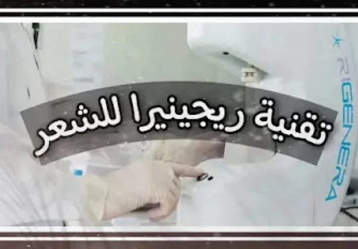 ريجينيرا الشعر زرع الشعر المجهري - Regenera Activa