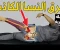 صورة مقال عرق النسا الكاذب