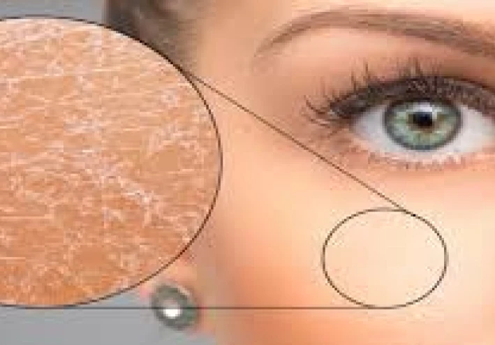 جمال البشرة الجافة وكيفية المحافظة عليها ومميزاتها وعيوبها وأسرارها