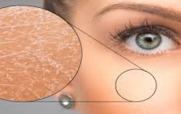 جمال البشرة الجافة وكيفية المحافظة عليها ومميزاتها وعيوبها وأسرارها