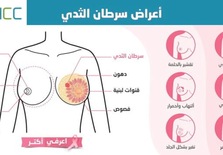 ما هي أعراض مرض سرطان الثدي؟