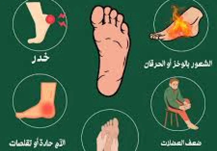 ما هو الاعتلال العصبي السكري؟ تلف الأعصاب الذي يجب أن نأخذه على محمل الجد