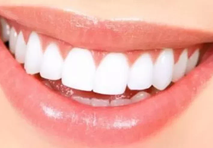 5 مكونات من مطبخك تجعل أسنانك أكثر بياضا