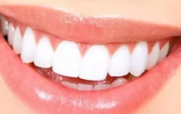 5 مكونات من مطبخك تجعل أسنانك أكثر بياضا