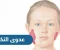 صورة مقال التورم المؤلم للغده اللعابيه