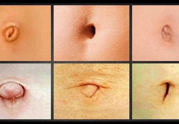 سرّة البطن: نافذة على الصحة أم مجرد نُدبة؟ حقيقة ما تكشفه سرّتك عن صحتك