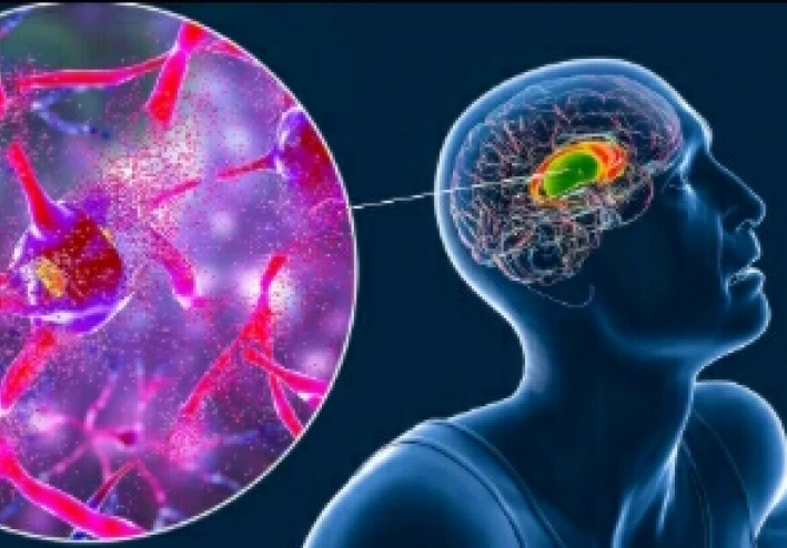 عندما يهاجم الجين المتحور الدماغ.