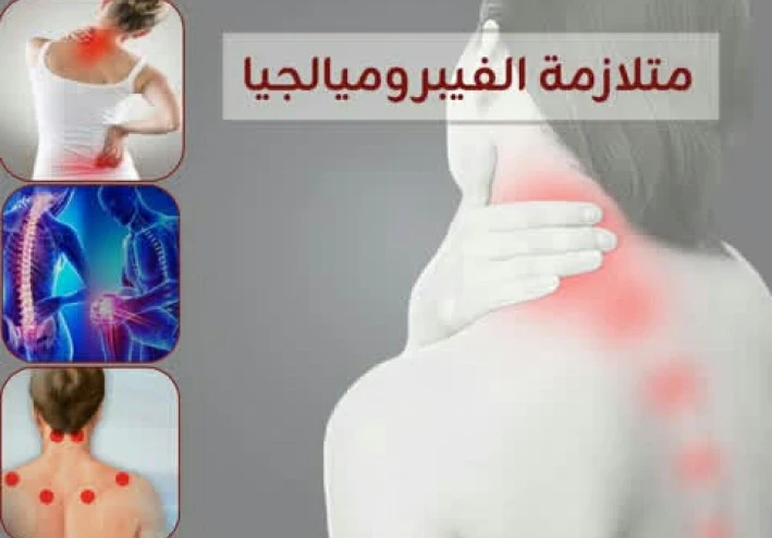 متلازمه الألم المزمن والتعب الشديد