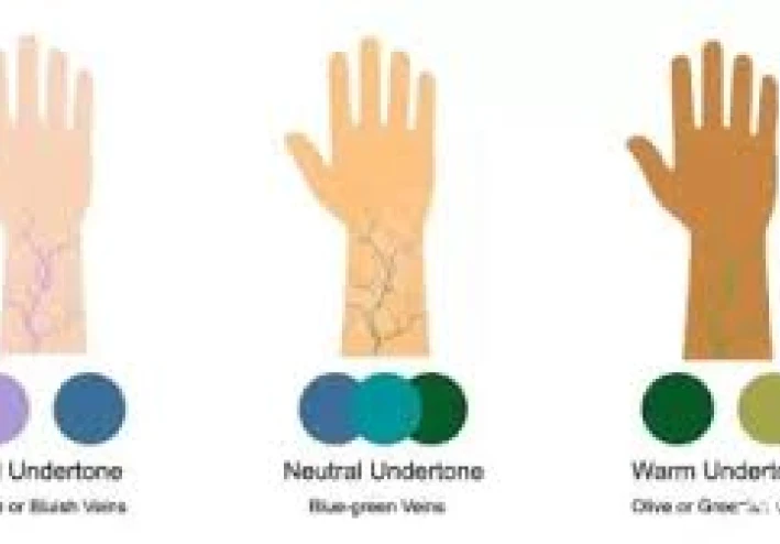 ما هو الأندرتون؟