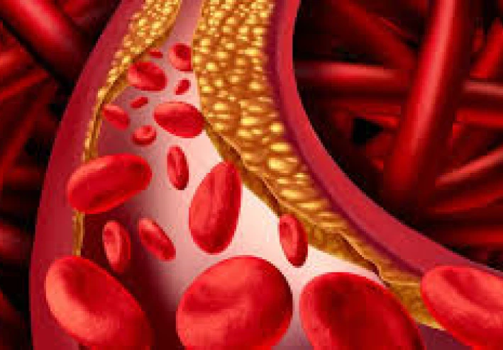 فرط شحميات الدم لدى مرضى السكري: الأسباب، الأعراض والعلاج