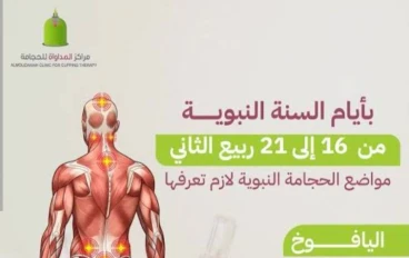 فوائد الحجامه للجسم 